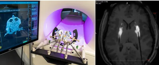 CNS: ClearPoint Navigation CNS: ClearPoint Navigation