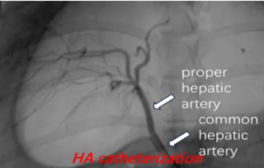 HA catheterization HA catheterization
